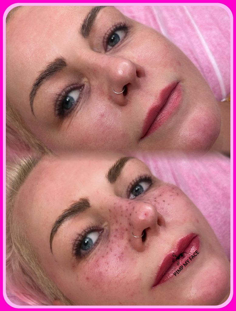 Permanent Make Up Sommersprossen - Freckle - Hamburg - Norderstedt